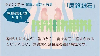 やさしく学ぶ　尿路結石